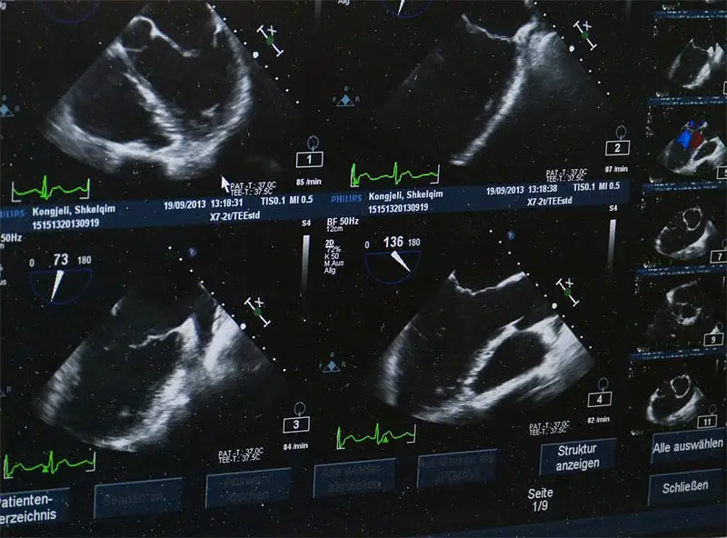 ultrasound image