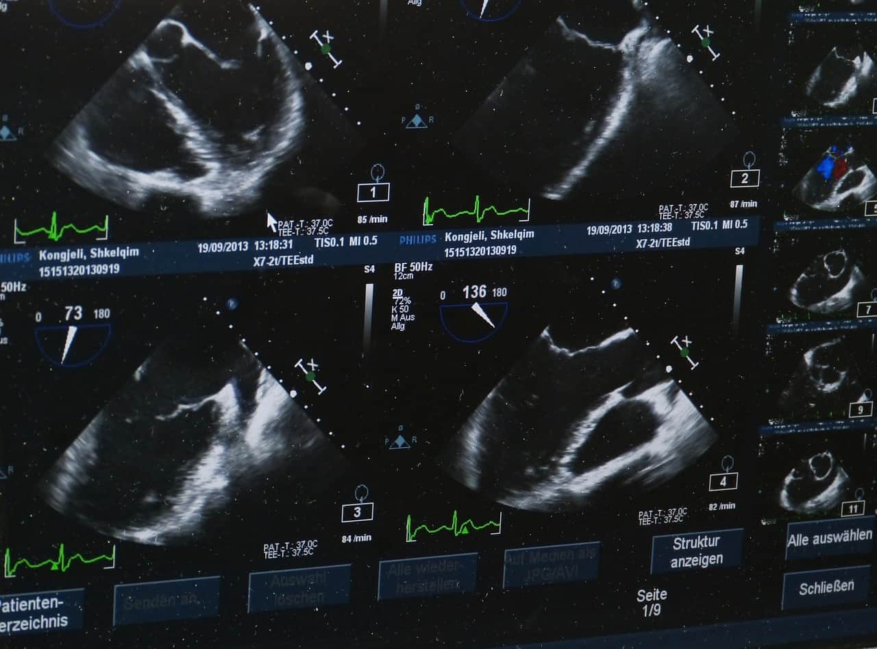 Ultrasound images
