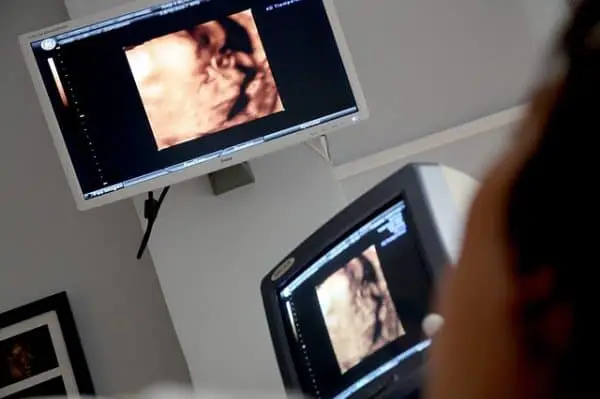 ultrasound techinician monitoring